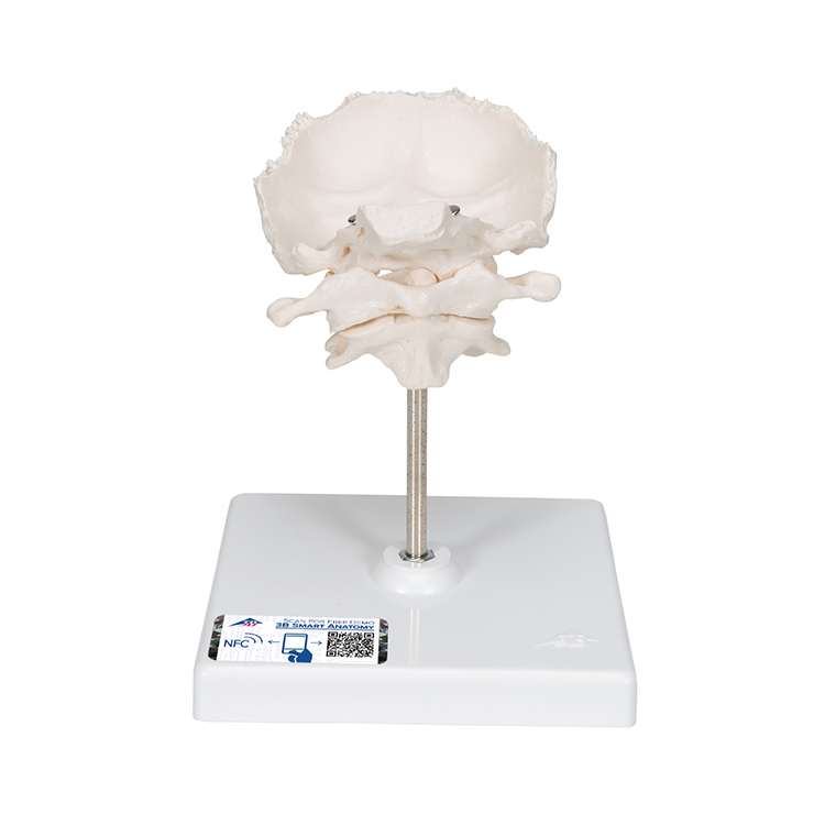 Atlas en draaier met achterhoofdsbeen