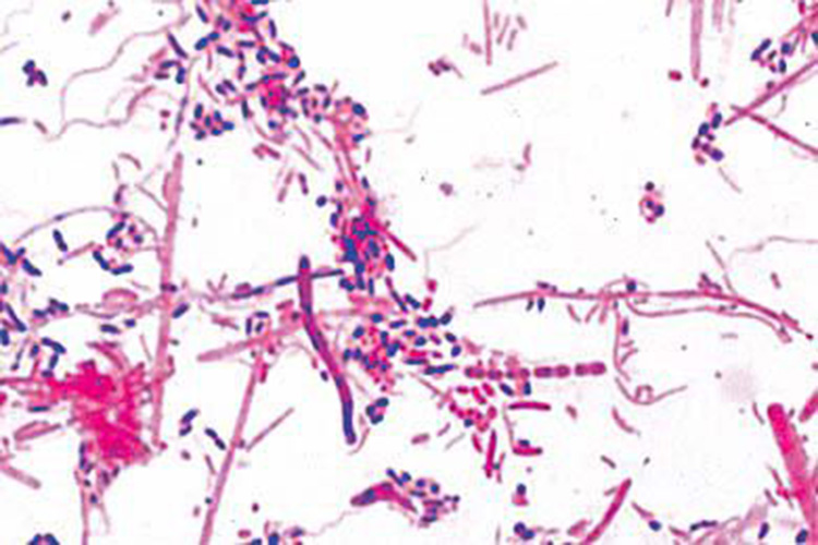 Bacteriën uit de mond (preparaat)